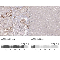 Arylsulfatase B/ARSB Antibody, Novus Biologicals 0.1mL; Unlabeled:Antibodies,